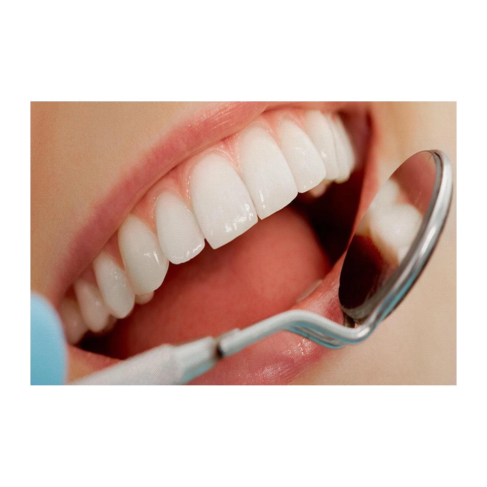 Radiant Smile Dental Art Wall Art